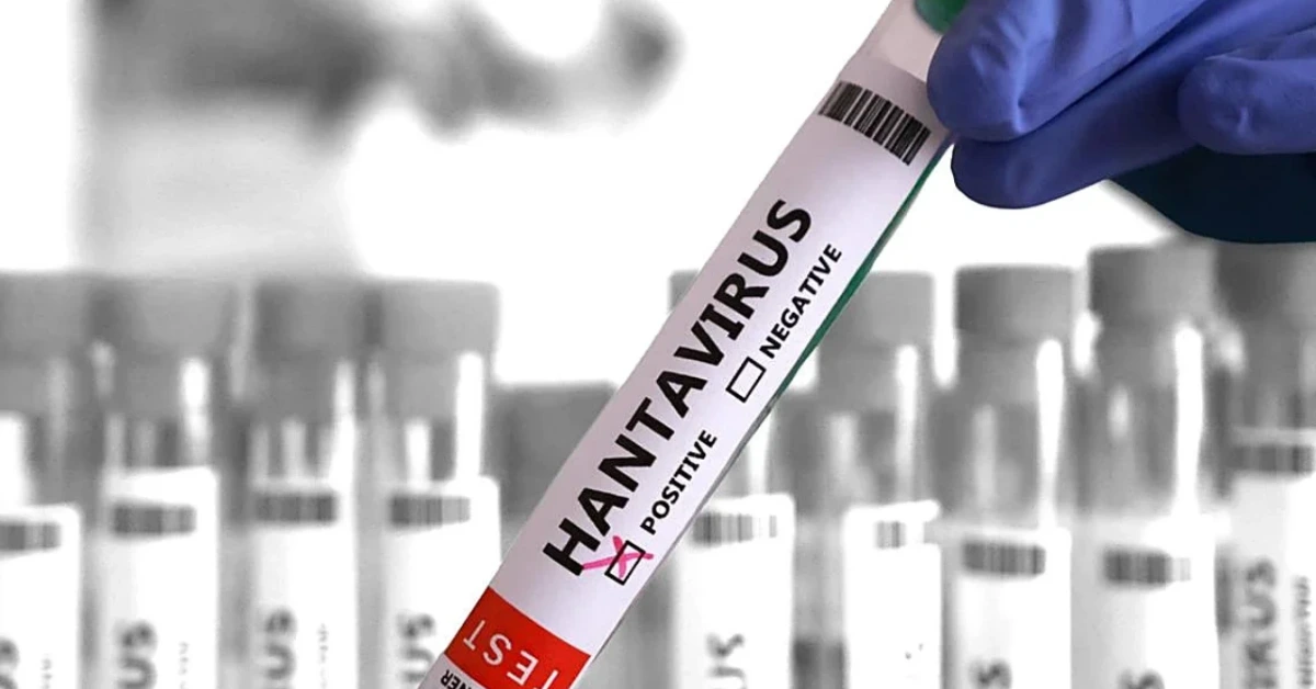 Gloved hand holds a test strip labeled 'HANTAVIRUS' with a checked NEGATIVE box, set against a blurred lab background.