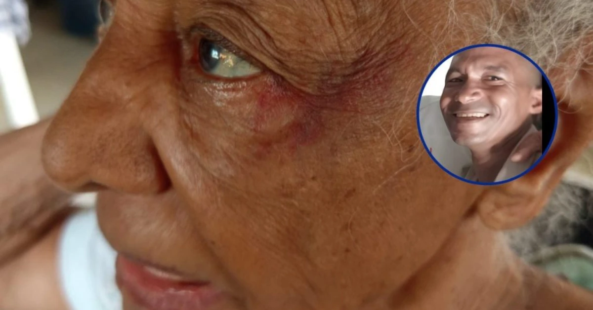 Close-up of an elderly woman's face with a circular inset photo of a smiling man over her ear.
