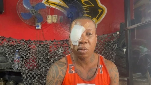 Hombre resulta severamente afectado tras conflicto con individuo en Jacagua