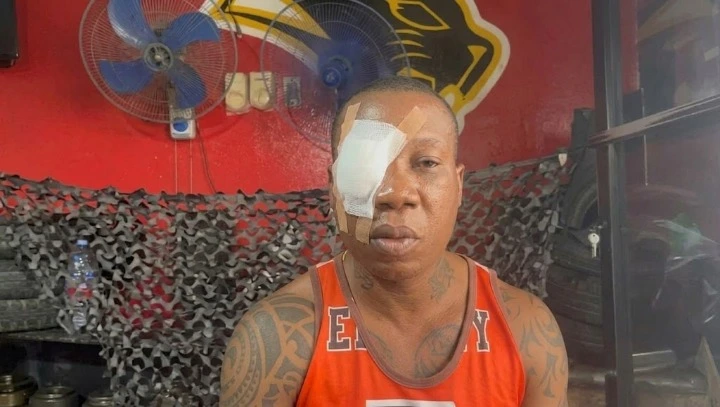 Man with a medical eye bandage on his left eye sits indoors, tattoos visible on his arms, wearing an orange jersey.